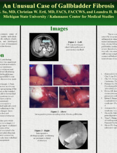 Case Report Poster Presentation Template  Example