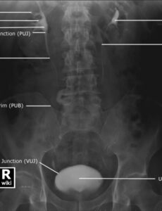 Best Editable Abdominal X Ray Report Template Example