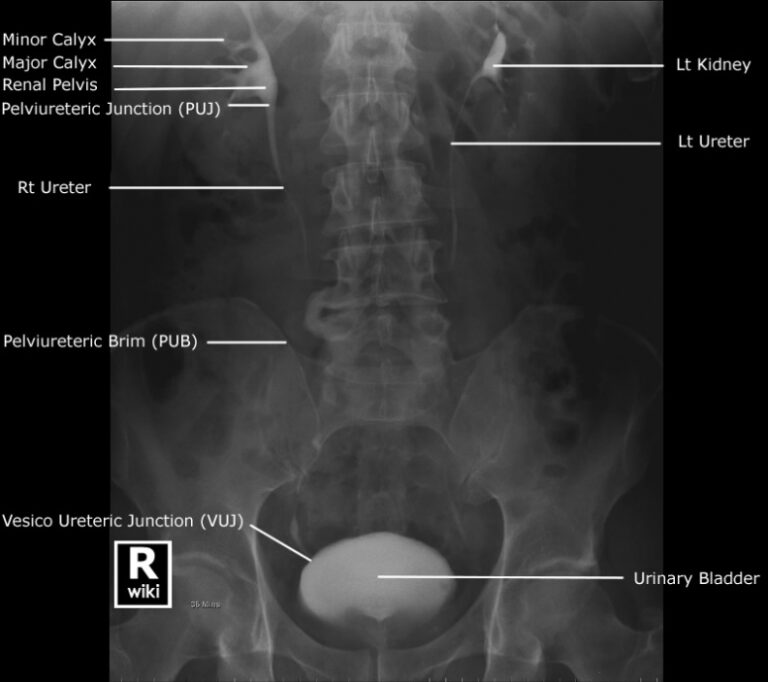 Best Editable Abdominal X Ray Report Template Example - Tacitproject