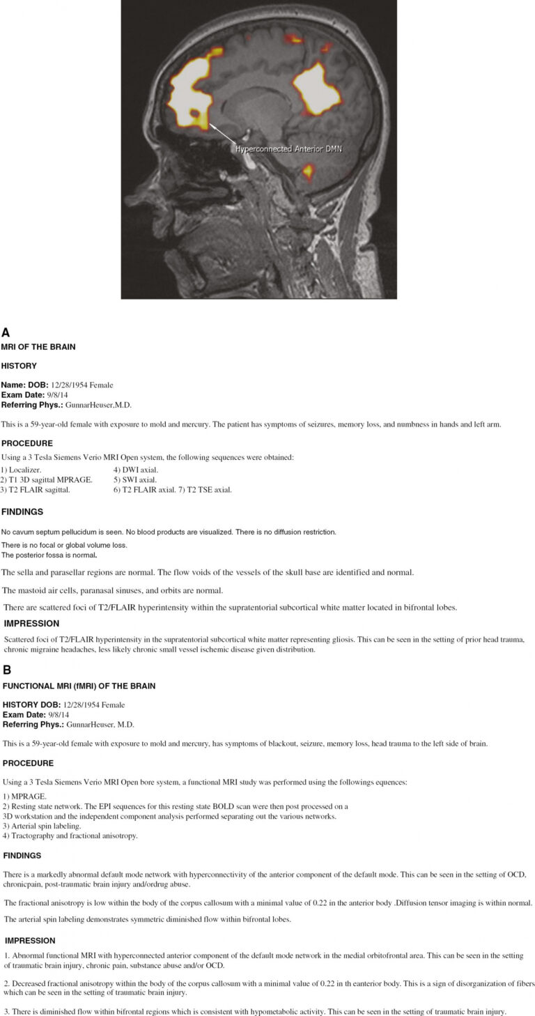 Free Printable Bone Age Radiology Report Template - Tacitproject