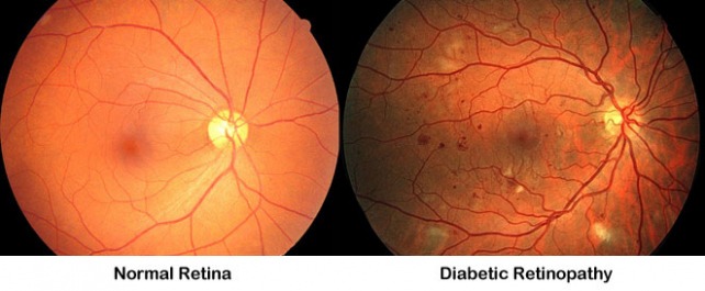 Top  Diabetic Eye Exam Report Template Sample