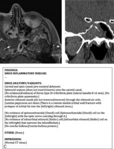 Top Editable Bone Age Radiology Report Template Word